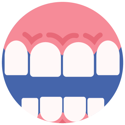 TMJ-and-bite-issues-icon