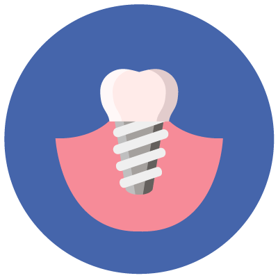 dental-implants-icon