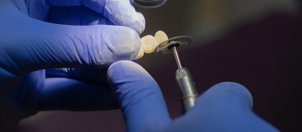 Dental Implants 101