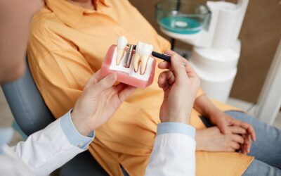 How Much Do Dental Implants Cost in Pittsburgh? And What Affects the Price  
