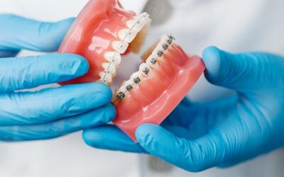 Invisalign vs. Braces: Which Is Right for You? A Pittsburgh Patient’s Guide