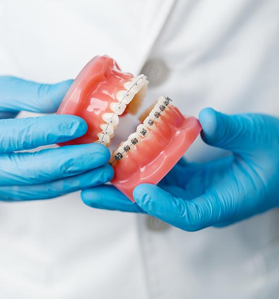 invisalign vs braces poling dental care